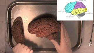 MIT Introduction to Neuroanatomy Series Part 1 [upl. by Segalman]