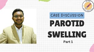 PAROTID SWELLING Case Discussion Part 1Surgery Made SimpleSMS by NBK [upl. by Autrey]