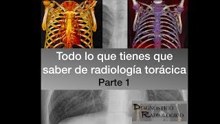 PRINCIPIOS DE RADIOLOGÍA TORÁCICA PARTE 1 Técnica y proyecciones [upl. by Yraek]