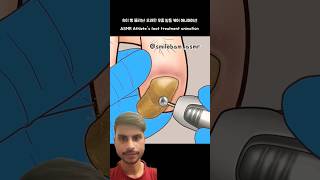 ATHLETE S FOOT TREATMENT ANIMATION gameplay rescue satisfying [upl. by Shulock784]