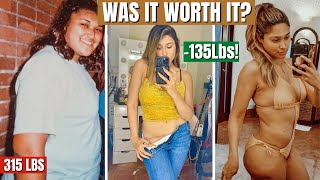 WHAT THEY DON’T TELL YOU ABOUT WEIGHT LOSS amp SURGERY How I lost 135 Lbs on the Keto Diet [upl. by Ulrike]