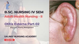 Otitis Externa Part2  Diagnosis Finding Management  Valinee Nursing Academy [upl. by Inalial]