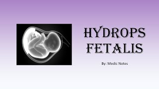 Hydrops fetalis  causes investigation management prognosis [upl. by Elyc499]