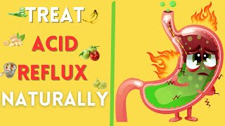 Treatment For Acid Reflux With 8 powerful foods [upl. by Eed351]