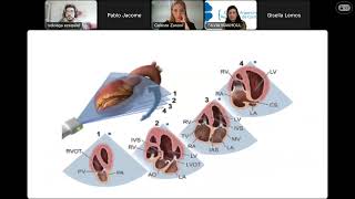 Introducción a la Ecocardiografia en UCO de CONAREC  Parte 1 [upl. by Noryt]