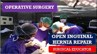 OPEN INGUINAL HERNIA REPAIR STEP BY STEP Operative Surgery [upl. by Shedd]