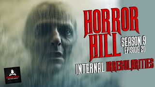 quotInternal Irregularitiesquot S9E20 💀 Horror Hill Scary Stories Creepypasta Podcast [upl. by Viradis]