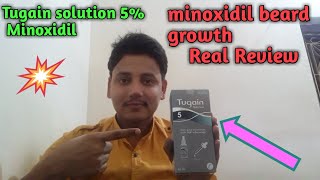 Cipla Tugain 5 solution minoxidil genuine review beard [upl. by Katinka]