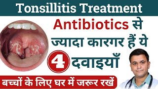 Tonsils Homeopathic medicine Tonsillitis Homeopathic Treatment Best homeopathic medicine for tonsils [upl. by Tada]