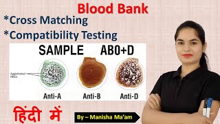 Cross Match Test in blood bank  Technique of cross matching  cross matching blood procedure [upl. by Wenz]