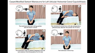 CasaniModified Semont Manoeuvre for Left Utricular Horizontal Canal Cupulolithiasis [upl. by Attiuqahs405]