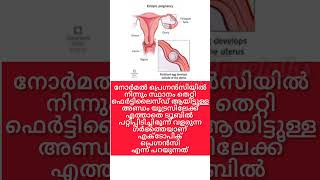 Ectopic pregnancy Reasons treatment pregnancycaremalayalam babyremidies [upl. by Lemrahs595]