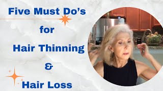 Five Must Do’s for Thinning amp Hair Loss [upl. by Aw]