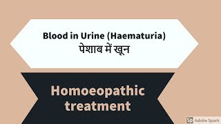 पेशाब में रक्त का कारण Blood in Urine Haematuria homoeopathic treatment [upl. by Oinotnanauj]