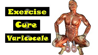 exercise for work cure varicocele [upl. by Eduam]