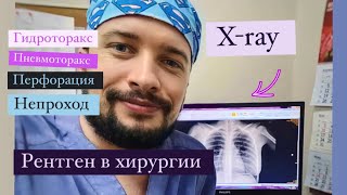 Xray in surgery Рентгенография в хирургии Научим видеть рентгенкартину в двух словах [upl. by Enutrof]