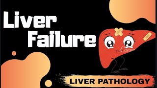 Acute and Chronic Liver failure Liver Pathology  Med Bees [upl. by Roel353]