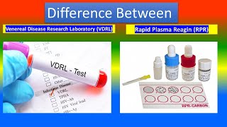 Venereal disease research laboratory VDRL test Vs Rapid plasma reagin RPR test [upl. by Ailekahs495]