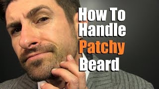 How To Deal With A Patchy Beard  Bald Spot Reduction Tips [upl. by Notyad192]