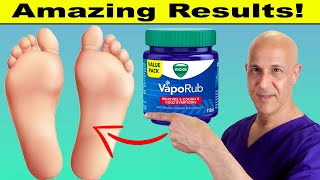 Rub VICKS VapoRub on Your Feet and Toes and Discover What Happens Next Dr Mandell [upl. by Mersey]