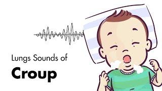 Sounds of Croup Laryngotracheitis  Lung Sounds  MEDZCOOL [upl. by Kcod]