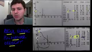 Spirometrie 8  recul elastic pulmonar crescut [upl. by Billat]