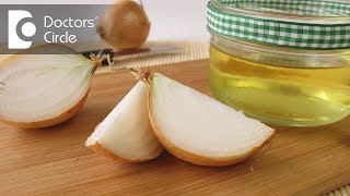 Time period required for hair regrowth after applying onion juice for hair loss  Dr Mini Nair [upl. by Noyerb]