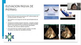 Gasto cardiaco Revision bibliografica  Unidad de Ultrasonografia de Emergencias [upl. by Nairrad]