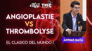 CARDIOLOGIE  Angioplastie VS Thrombolyse  Anwar Baza [upl. by Langham434]