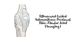 ultrasound Guided Interventions Proximal TibioFibular Joint Imaging [upl. by Nahtad]