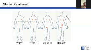 Treatment options for DLBCL [upl. by Aehsan]