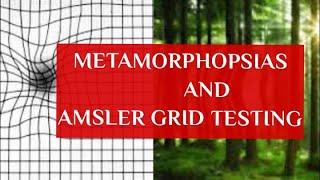 METAMORPHOPSIAS and AMSLERS GRID TESTING [upl. by Farleigh]