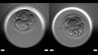 2 Selected Embryos [upl. by Beverley]