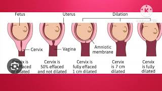 cervical effacement dilatation showuterine contraction  lectureenglishmedical education [upl. by Krantz]