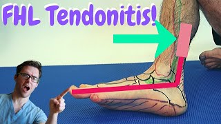 Flexor Hallucis Longus PAIN FHL Tendonitis BEST Treatment [upl. by Kayla]