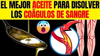 Derretir coágulos de SANGRE de forma NATURAL 6 ACEITES poderosos PRINCIPALES [upl. by Nosiram445]