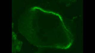 Osteoclast actin belt retraction from calcitonin treatment [upl. by Aicilra671]