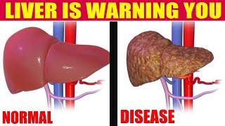 HOW CAN LIVER DISEASES AND CAUSES SYMPTOMS TREATMENT  Nature Cure Fit [upl. by Delija486]