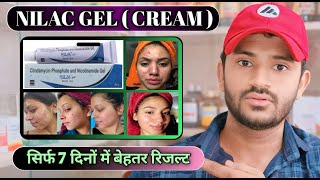 Nilac gel uses in hindi how to use nilac gel [upl. by Piegari613]