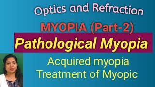 Myopia Part 2 Pathological myopia Acquired myopia Treatment of Myopia [upl. by Esilrahc476]