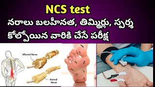 NCS Test  Nerve Conduction Study Procedure in Telugu [upl. by Nosnek]