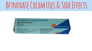 Betnovate Cream for Skin Problems – Everything You Need to Knowquot [upl. by Ranilopa]