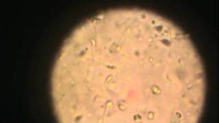 Observación de espermatozoides en microscopio óptico 1 [upl. by Ecam]