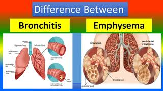 Difference Between Chronic Bronchitis and Emphysema [upl. by Hurlbut]