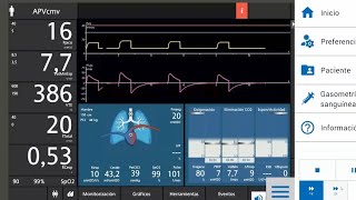 Ventilación mecánica [upl. by Patin]