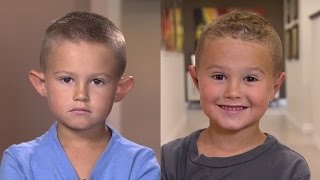 Parents Allow 6YearOld Boy with Big Ears to Get Plastic Surgery [upl. by Killam]