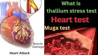 thallium stress test for heartthallium stress testthallium stress test in hindimuga test [upl. by Gnilsia]