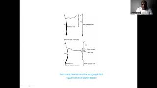 Grade 12 Geomorphology River capture [upl. by Naiviv]