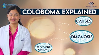 Coloboma Explained Causes Diagnosis and Treatment Options  Dr Shreya Nayak [upl. by Kelci]