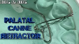 palatalcanineretractor palatalcanineretractorfabrication palatal canine retractorstep by step [upl. by Nerissa566]